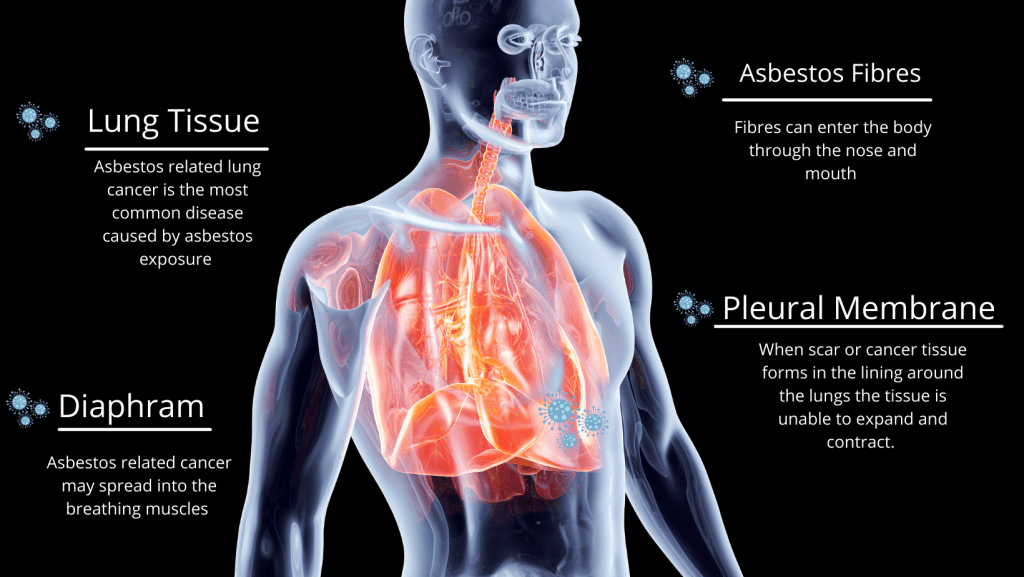 Image detailing how asbestos can effect the body