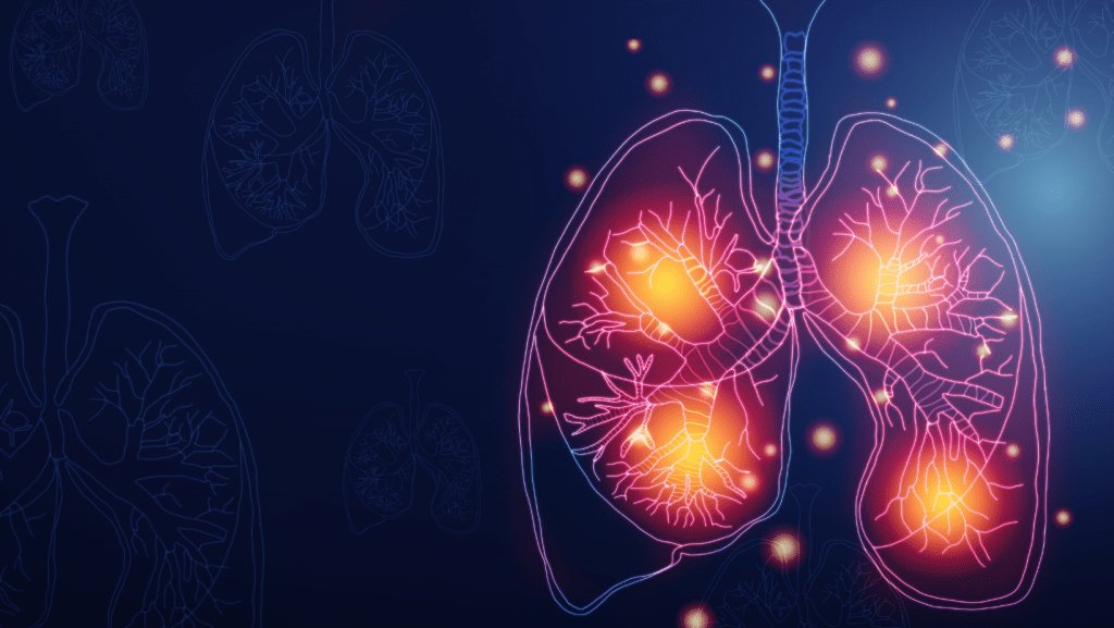 Asbestos dust in lungs